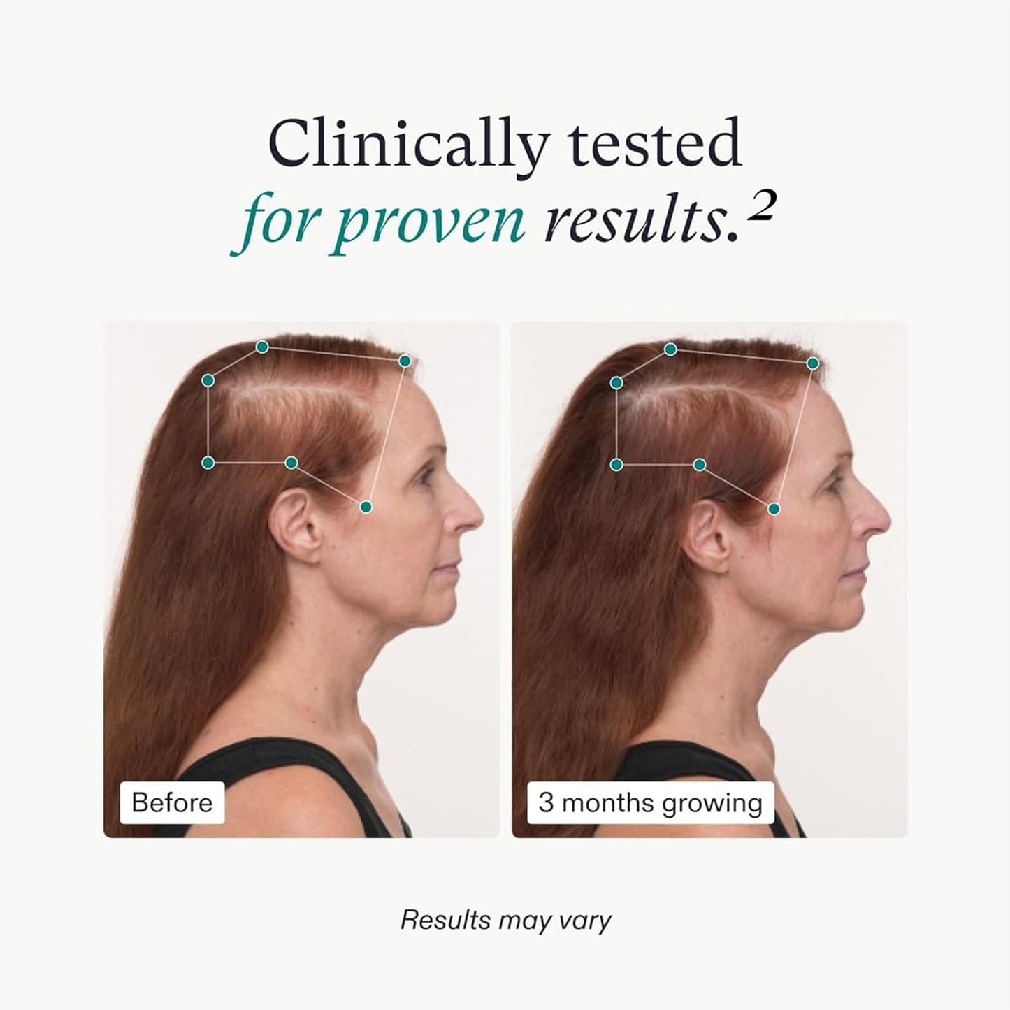 Nutrafol Hair Growth Supplements for Men & Women (Ages 18–45+) | 1-Month Supply